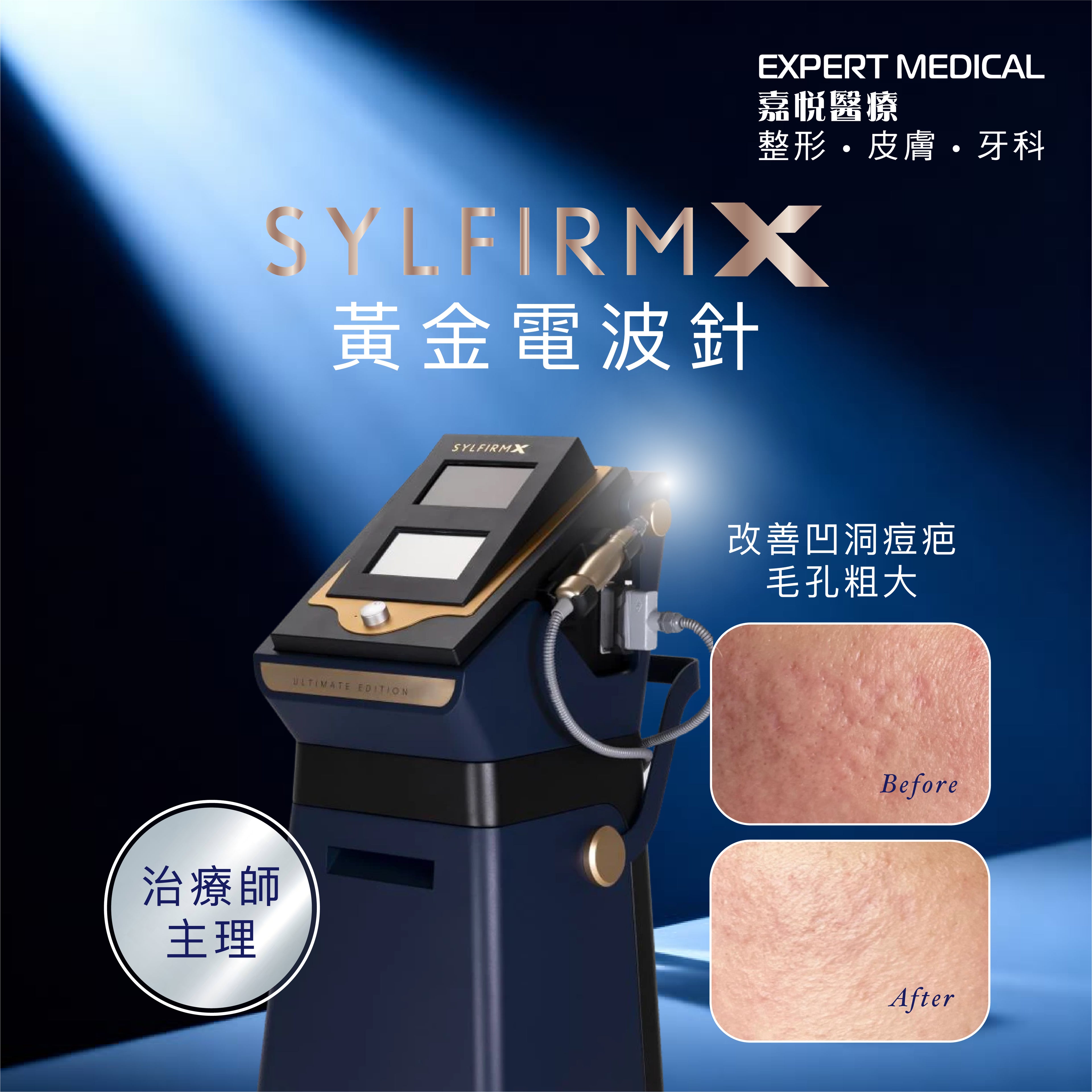 Sylfirm X 黃金電波針 (治療師主理)